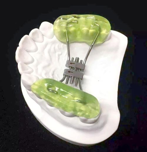 正畸彩色自凝材料-图3 正畸彩色自凝材料-图3