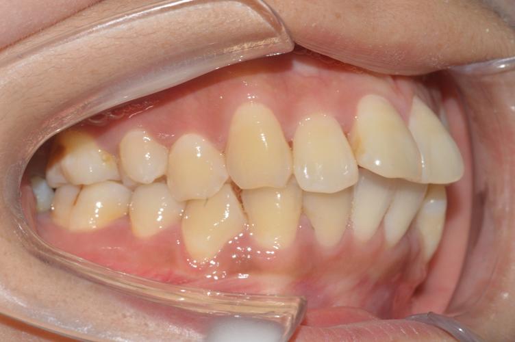 北京康圆口腔正畸-图1