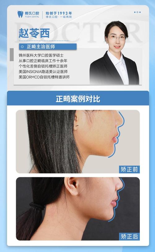 正畸尖牙关系案例中，尖牙III类关系如何矫治？-图3