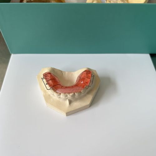 正畸牙齿上为何要加弹簧？作用原理是什么？-图1