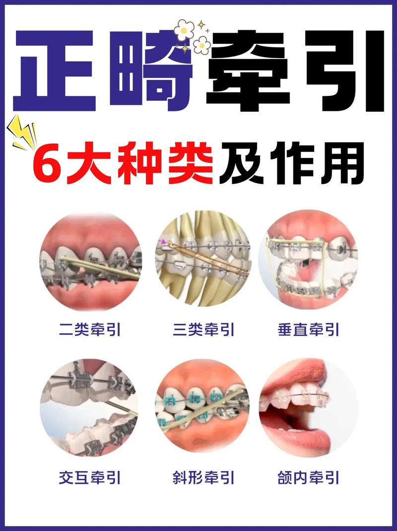 正畸和平面的控制-图1