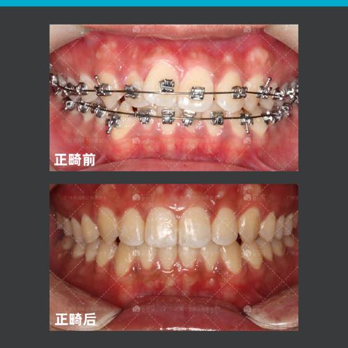 广州博济牙科正畸-图2