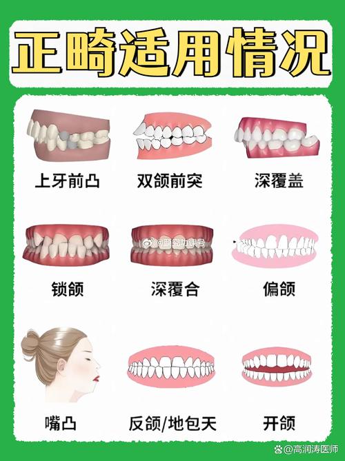 哪种正畸保护蜡好-图1