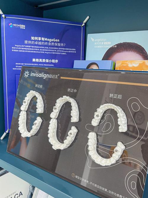 修正正畸之家加盟-图3