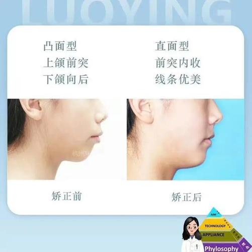 口腔正畸科拔牙么-图3