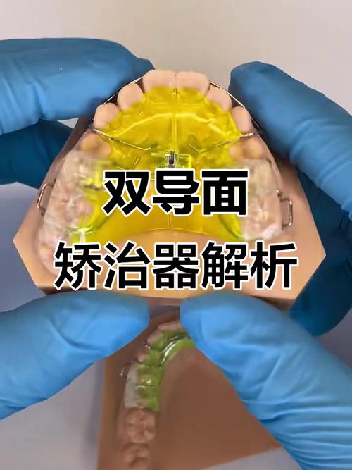 口腔正畸颌垫制作的关键步骤有哪些？材料选择与注意事项如何？-图3