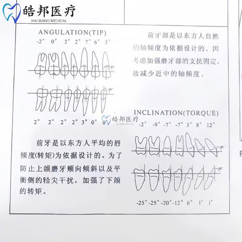 正畸弓丝左右滑动，原因是什么？影响矫正效果吗？-图3