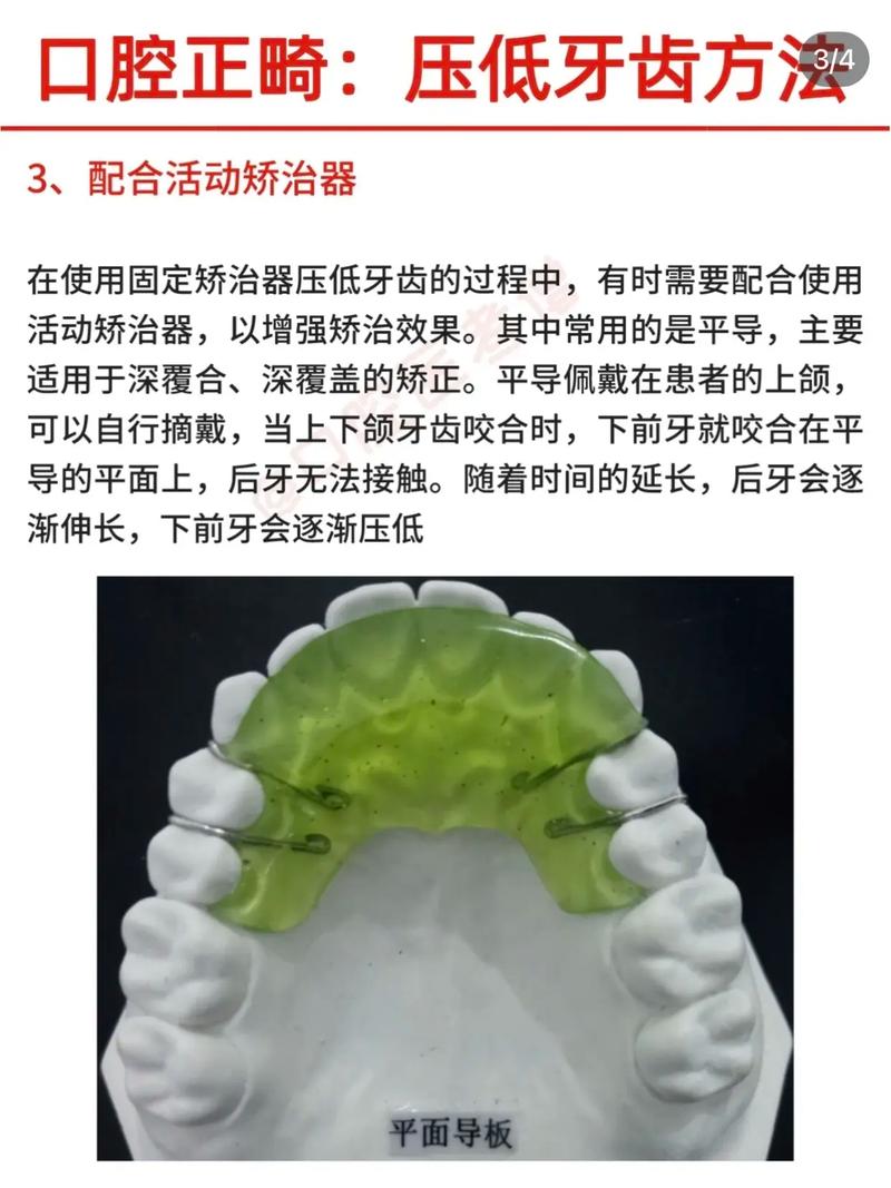 正畸摇椅怎么弯制-图3