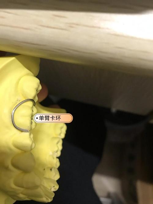 正畸单臂卡环弯制-图1