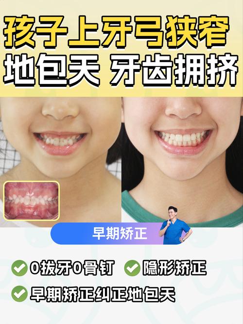 乳牙可以做正畸么-图1 乳牙可以做正畸么-图1