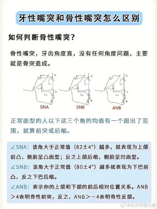 如何判定正畸骨性？关键临床指标与方法有哪些？-图1