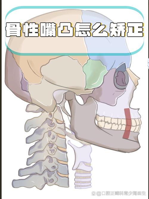 如何判定正畸骨性？关键临床指标与方法有哪些？-图2