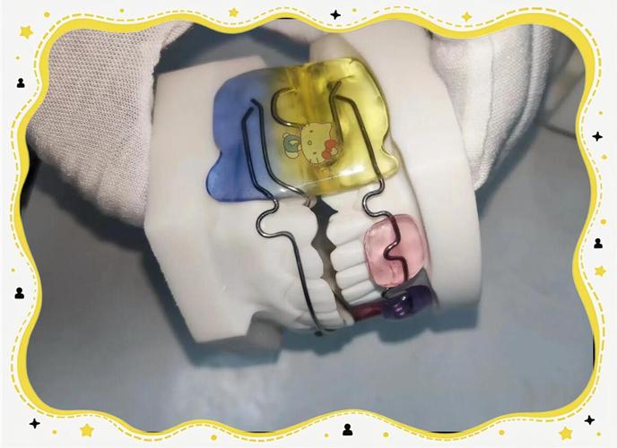 fr三型正畸技术-图1