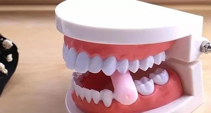 正畸胶边缘发黑是何原因？如何有效处理？-图2