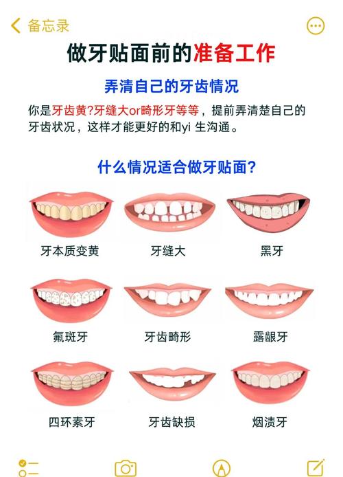 先正畸还是先贴面？顺序决定牙齿美观效果？-图2