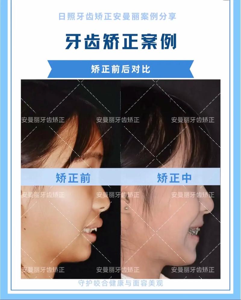 正畸和牙医的区别是什么？正畸属于牙医的专科分支吗？-图2