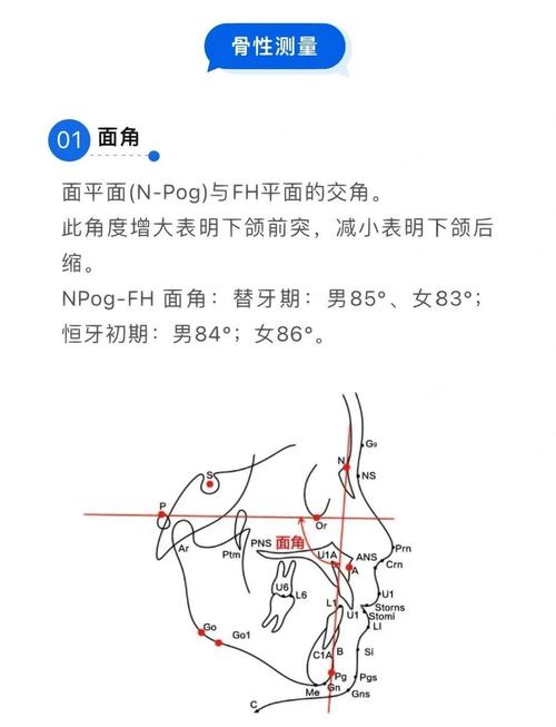 正畸中z角变小，其临床意义究竟是什么？-图1
