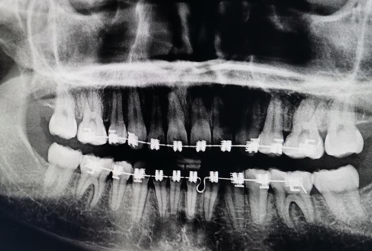 深圳美奥口腔正畸-图1