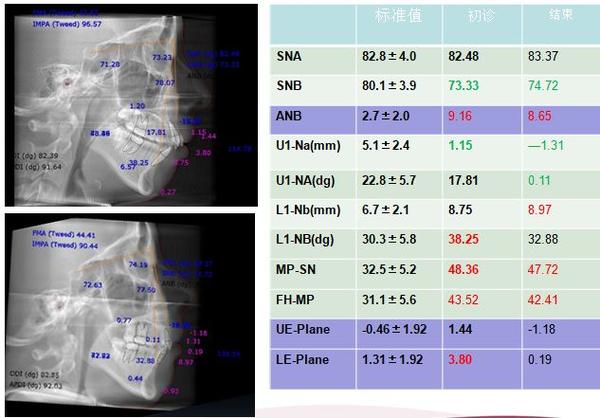 正畸头颅侧位软件-图2
