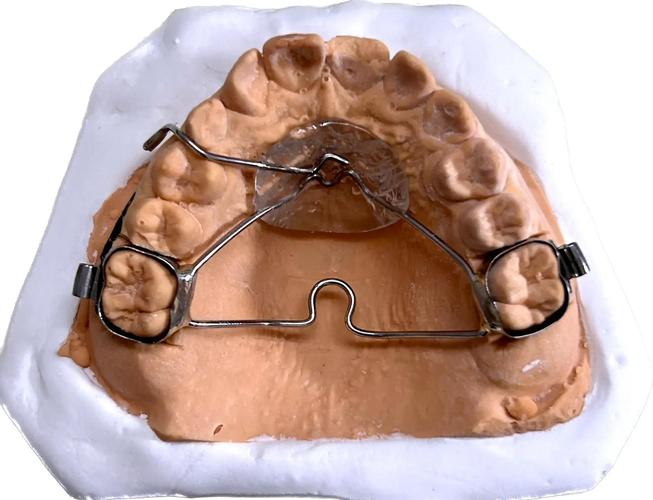 颚杆的作用 正畸-图2