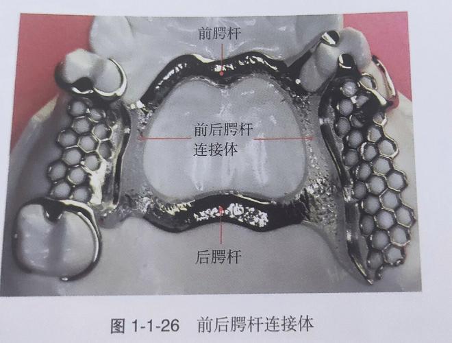 颚杆的作用 正畸-图1