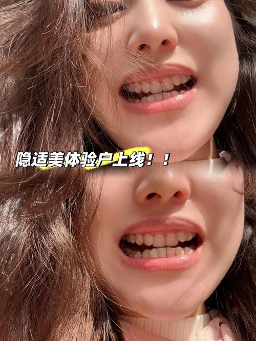 潍坊可恩口腔正畸效果如何？值得信赖吗？-图1