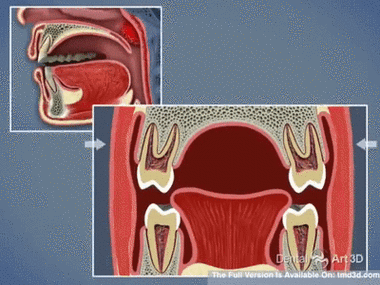 口腔正畸科口呼吸-图3