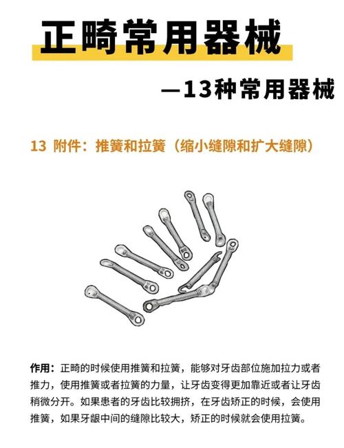 正畸的钳子叫什么-图1