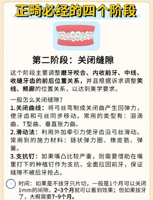 正畸矫正要做几次牙齿模型？取模次数因人而异吗？-图1