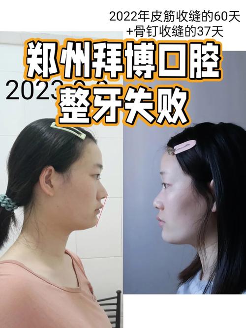 拜博 华西 正畸-图1