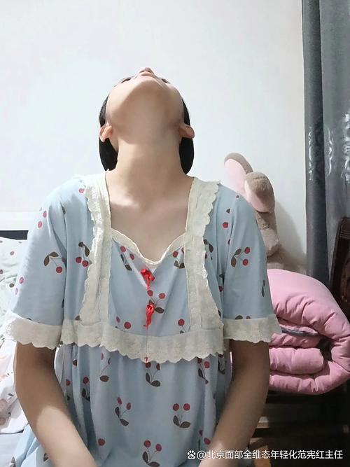 正畸导致下颌偏斜-图1