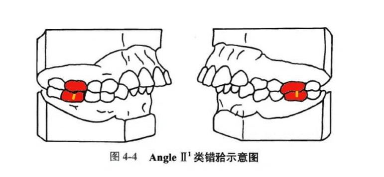 正畸咬合关系描述-图1