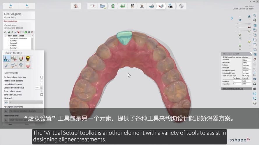 正畸主流设计软件-图1