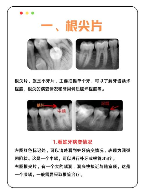 牙齿正畸拍片为何必要？包含哪些关键检查？-图1