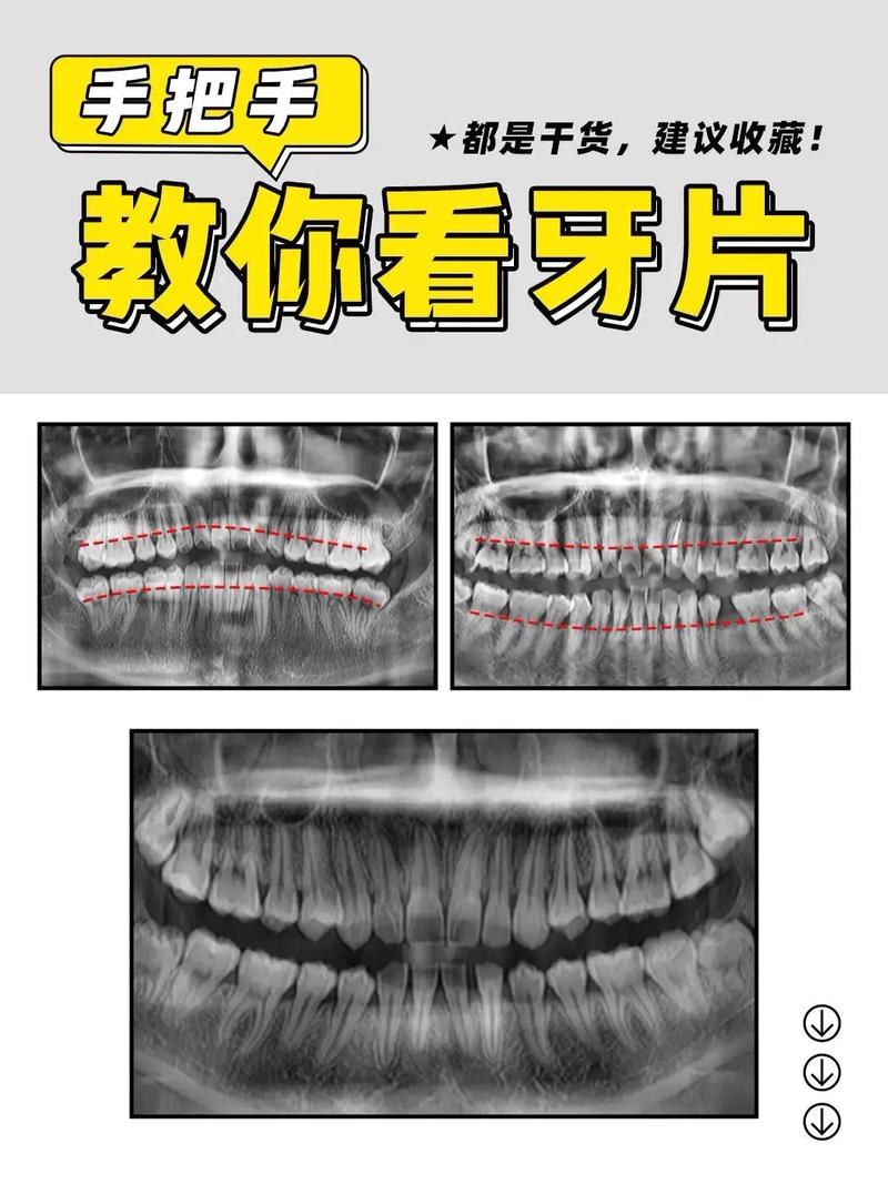 牙齿正畸拍片为何必要？包含哪些关键检查？-图2