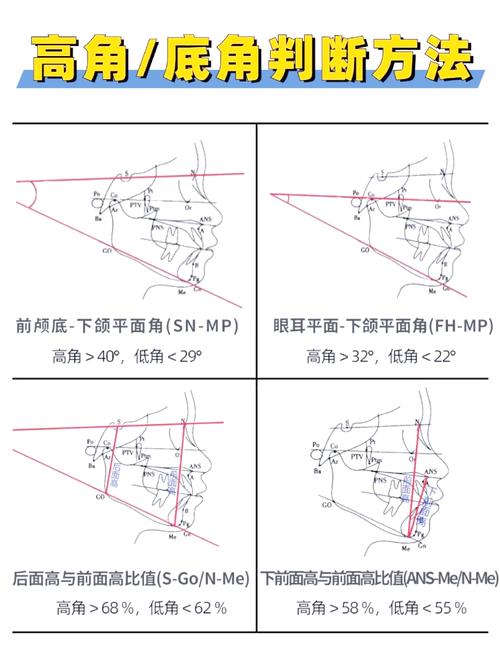 正畸角度测量标准-图1