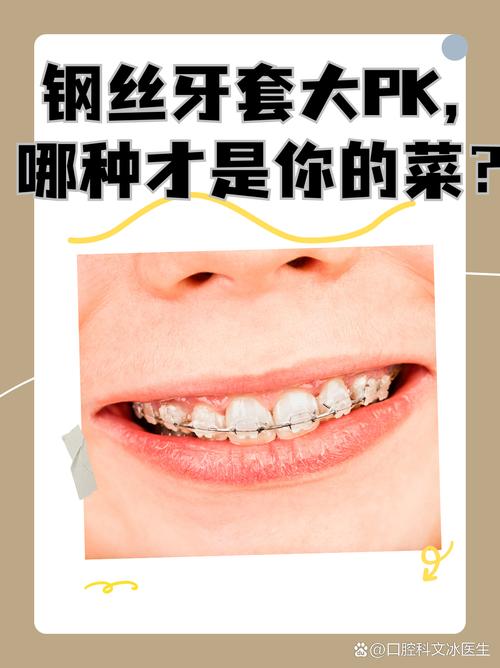 正畸钢丝种类有哪些？图片里都展示了哪些？-图3