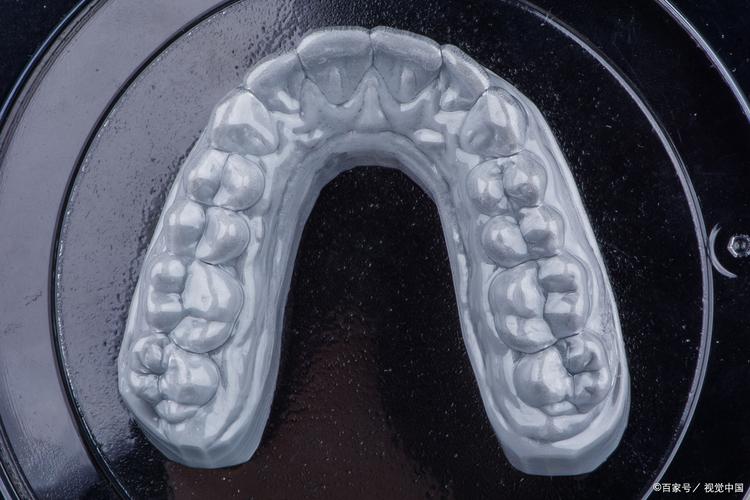 正畸食物卡在托槽-图2