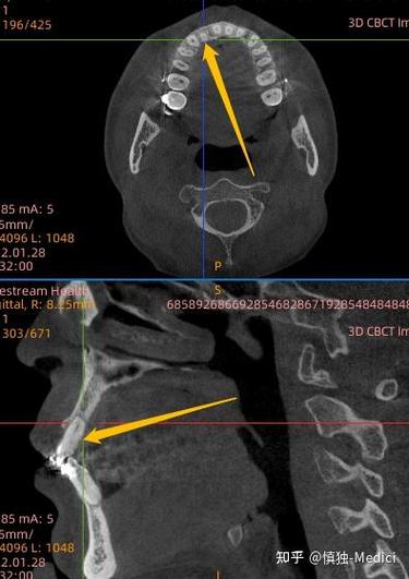 深圳北大正畸失败，责任究竟谁来担？-图2