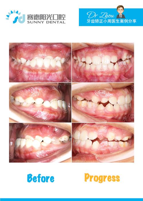 深圳北大正畸失败，责任究竟谁来担？-图3