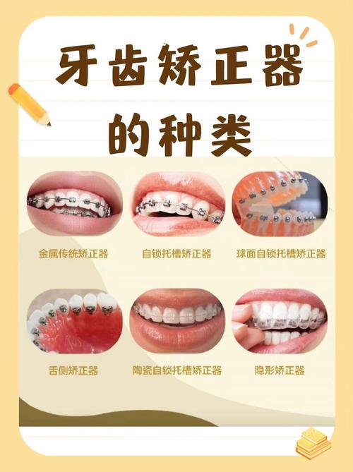 正畸托槽怎么辨别？实用方法技巧全在这！-图1