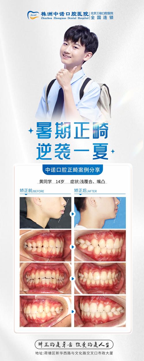 正畸照片编辑模板能解决哪些拍摄痛点？-图1