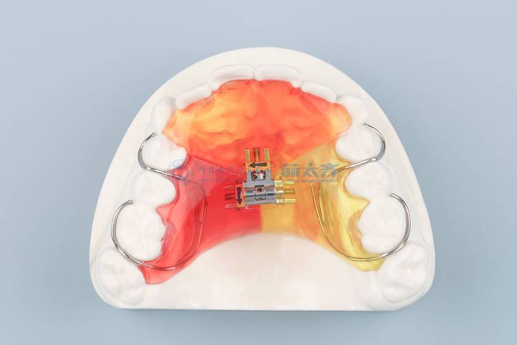 牙齿正畸辅助器材-图2