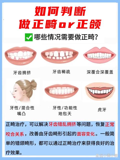 正畸凸面型的概念是什么？其正畸视角下的定义如何？-图2