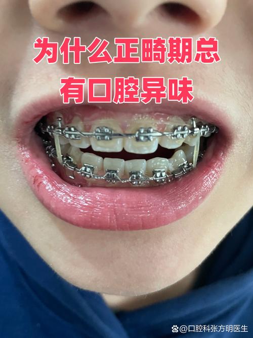 正畸失败案例退钱-图1