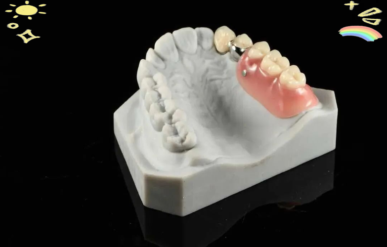 牙齿正畸牙齿附件-图1