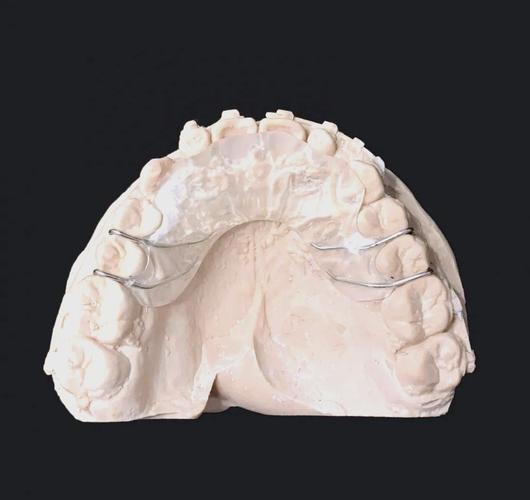 牙齿正畸导板图片-图1