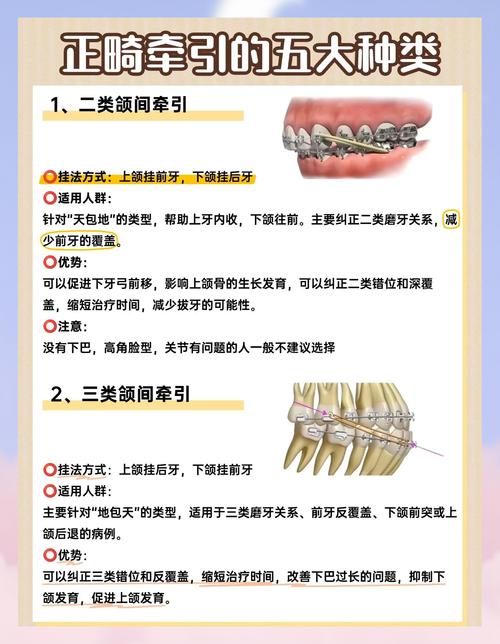 正畸治疗系统一般包括哪些主要组成部分和功能模块？-图3