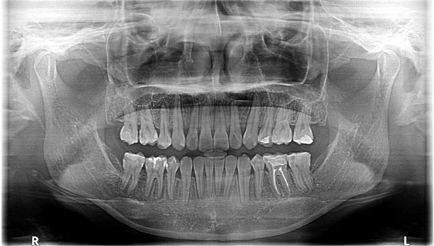 PPT画正畸片子-图2