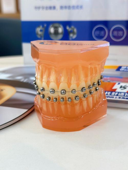 正畸隐形矫治附件对矫治效果有何关键影响？-图1